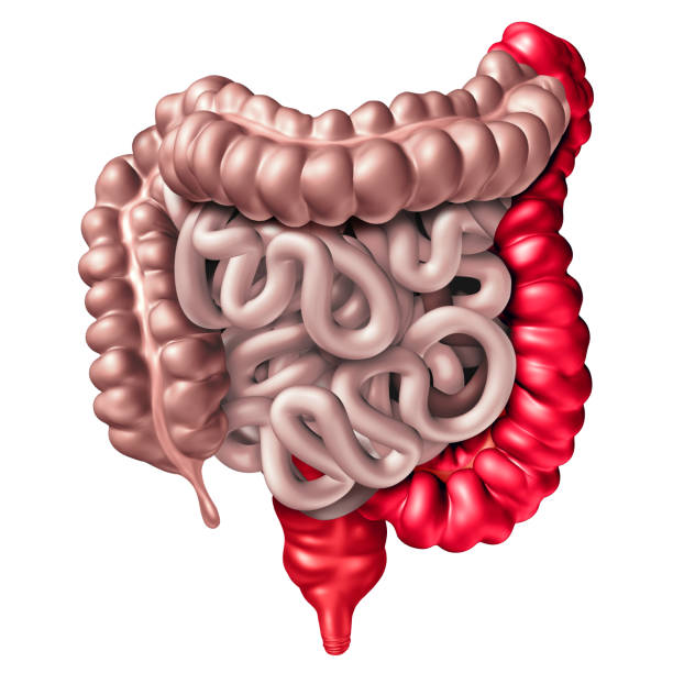 Imagem ilustrativa de Proctologista perto de mim em Goiás