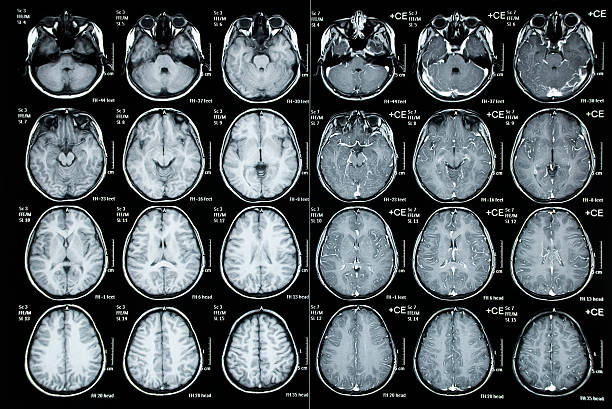 Imagem ilustrativa de Tomografia computadorizada da face em Goiás