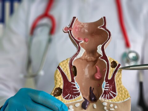 Imagem ilustrativa de Urologista preço popular